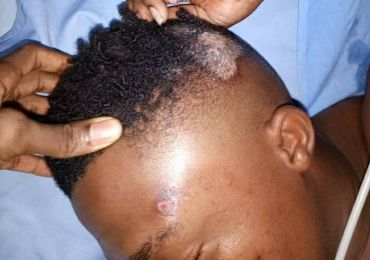 SARS VICTIM ALIVE - NOT SHOT BUT FELL FROM POLICE VEHICLE - KEYAMO